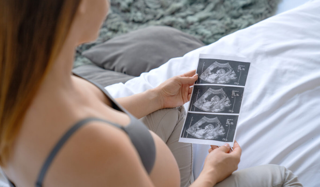 blog - ecografías en el embarazo